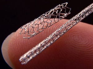 Stent in front of finger tip for scale